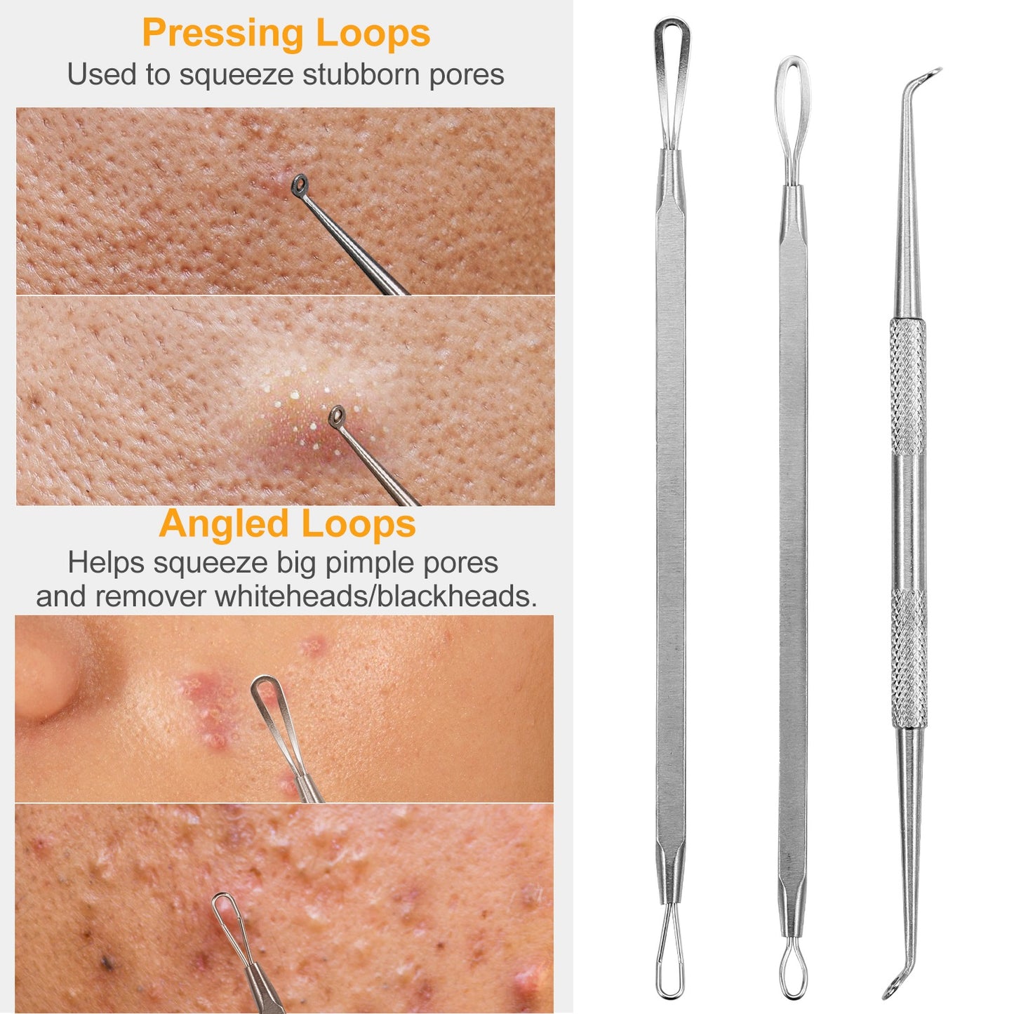 7 Pcs Blackhead Remover Kit Stainless Steel Pimple Comedone Acne Extractor