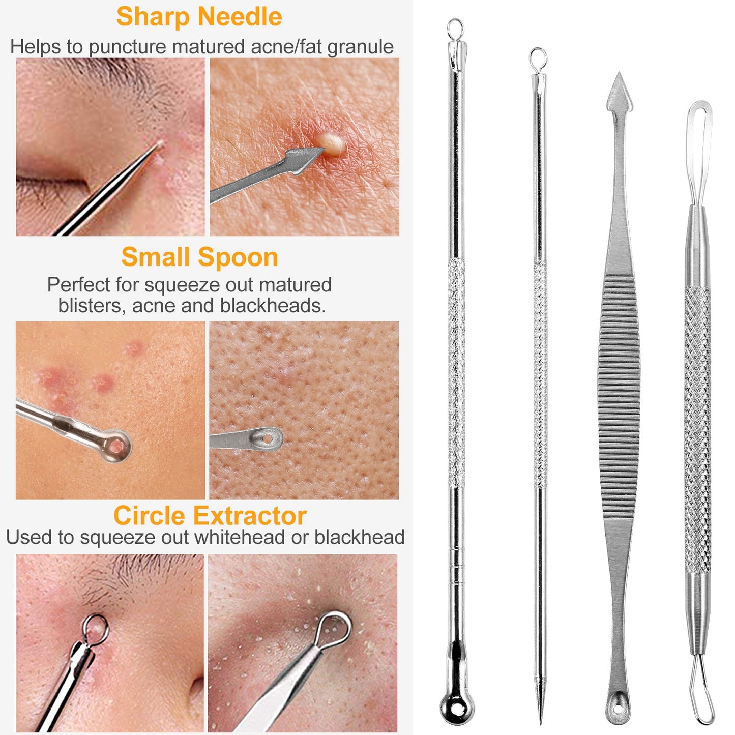 7 Pcs Blackhead Remover Kit Stainless Steel Pimple Comedone Acne Extractor