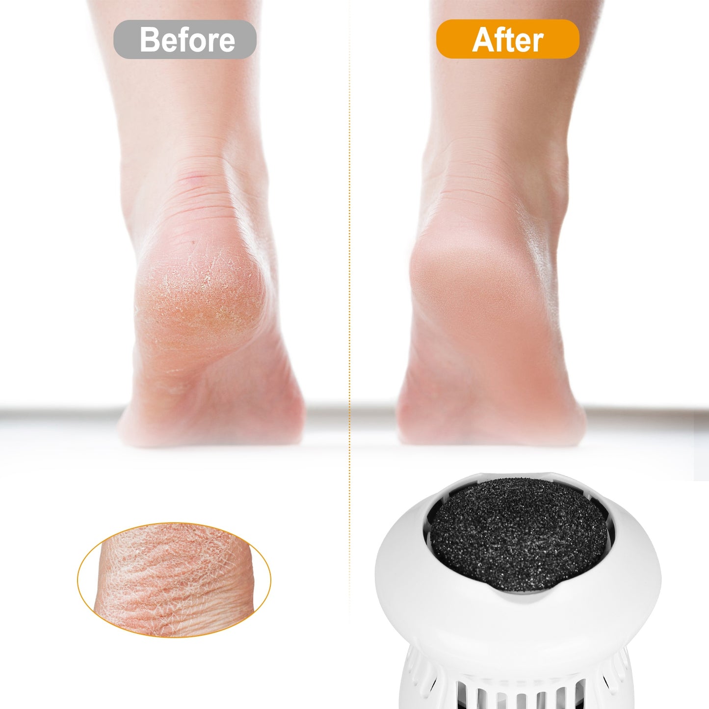 Electric Callus Grinder USB Rechargeable Foot File Callus Remover Vacuum Feet Pedicure Exfoliating For Cracked Heels Hard Callus