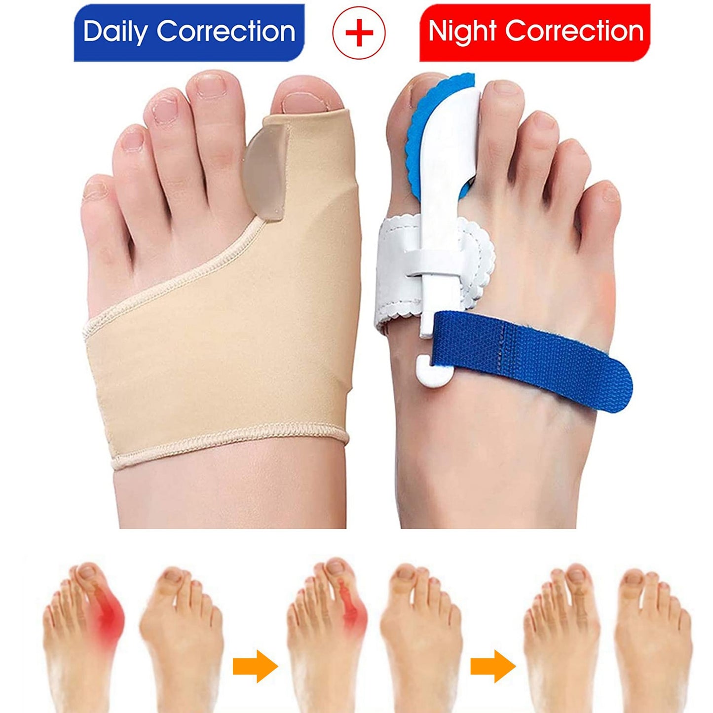Bunion Corrector Night Time Bunion Splints Bunion Relief Protector Sleeves Kit